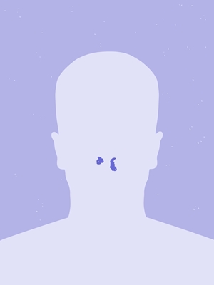 Hemorragias nasales de avatar