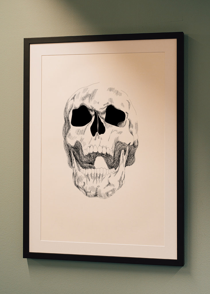 Traumatismo craneoencefálico